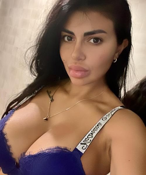 Hi, I'm Sara from Romania my pictures are 100% real I can confirm with video for any question please contact me privately 